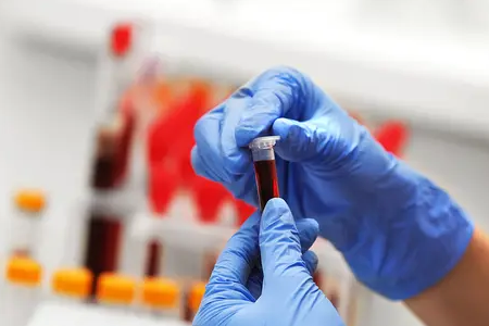 BABIO ফ্লুরোসেন্স বোভাইন প্রেগন্যান্সি র্যাপিড টেস্ট চালু করেছে