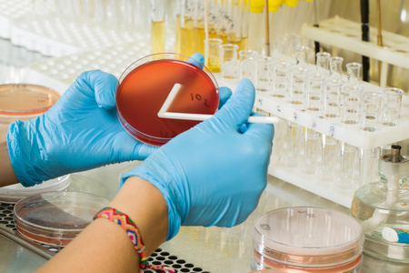 BABIO এর ম্যাককঙ্কি আগর মিডিয়াম - গ্লোবাল মাইক্রোবায়োলজিক্যাল ডায়াগনস্টিকসের জন্য প্রিমিয়াম সিলেক্টিভ আইসোলেশন